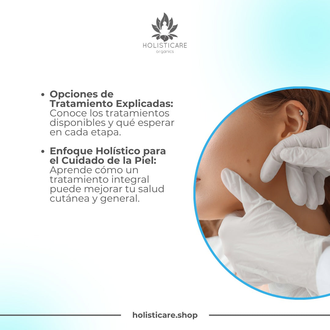 Lunares Malignos: Guía Esencial para Identificar y Tratar Lunares Sospechosos (EBOOK | Libro Digital) - HOLISTICARE